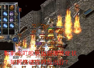 影刺虫叮咬后出现哪些症状?如何快速应对与治疗? 影刺虫叮咬后出现哪些症状?如何快速应对与治疗?